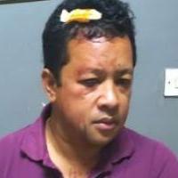 Ny Rado RAFALIMANANA : gravement bless&eacute; par une tentative d&rsquo;assassinat